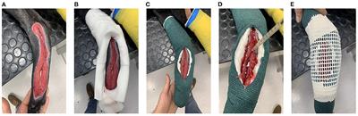 Case Report: A Novel Ventilated Thermoplastic Mesh Bandage for Post-operative Management of Large Soft Tissue Defects: A Case Series of Three Dogs Treated With Autologous Platelet Concentrates